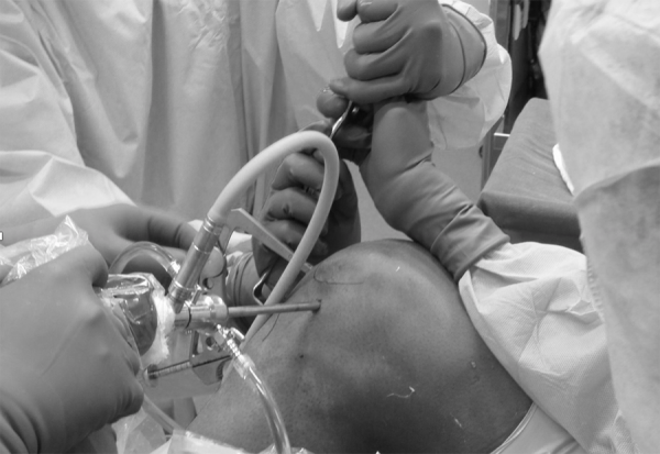 Αρθροσκοπικη χειρουργικη γονατος