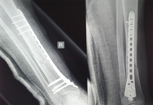 Χειρουργικη τραυματος